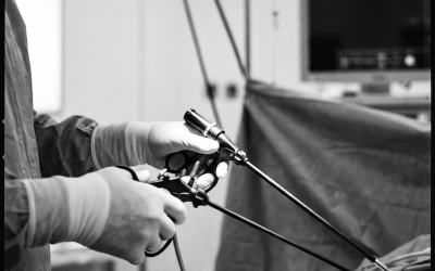 Laparoscopy Surgery in Nairobi